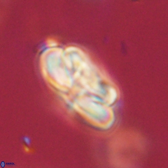 Heliolithus iptamenosdiskos 65782