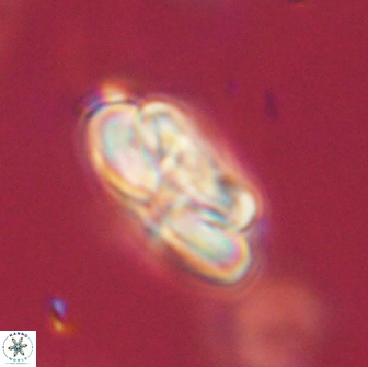 Heliolithus iptamenosdiskos 65782
