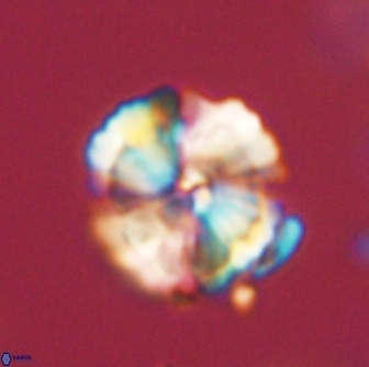 Heliolithus iptamenosdiskos 65786