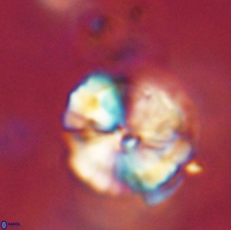 Heliolithus iptamenosdiskos 65787