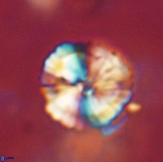 Heliolithus iptamenosdiskos 65791