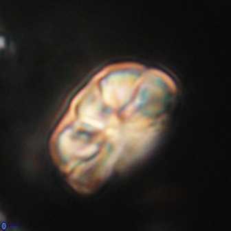 Heliolithus iptamenosdiskos 65797