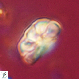 Heliolithus iptamenosdiskos 65798