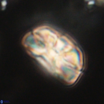 Heliolithus iptamenosdiskos 65801