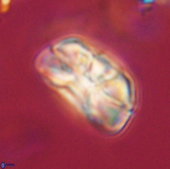 Heliolithus iptamenosdiskos 65802