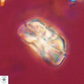 Heliolithus iptamenosdiskos 65802