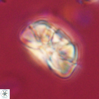Heliolithus iptamenosdiskos 65803