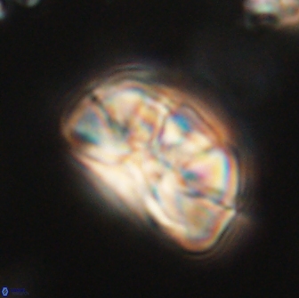 Heliolithus iptamenosdiskos 65804