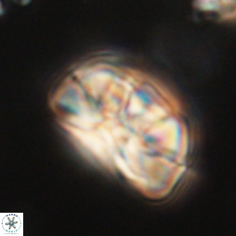 Heliolithus iptamenosdiskos 65804