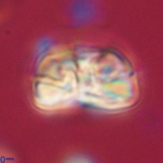 Heliolithus iptamenosdiskos 65807