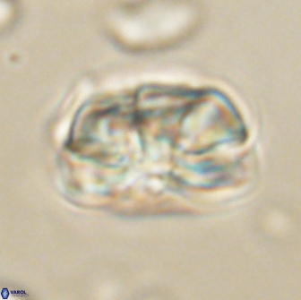 Heliolithus iptamenosdiskos 65808