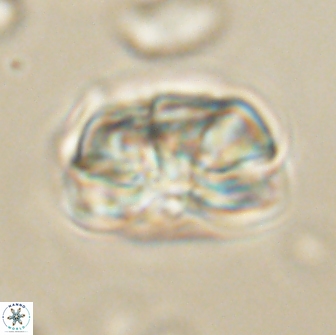 Heliolithus iptamenosdiskos 65808