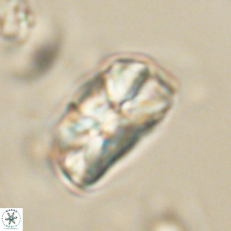 Heliolithus iptamenosdiskos 65810
