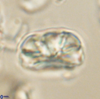 Heliolithus iptamenosdiskos 65811