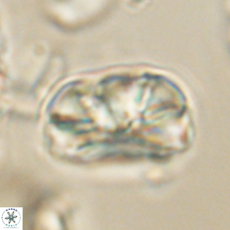 Heliolithus iptamenosdiskos 65811