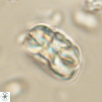 Heliolithus iptamenosdiskos 65812