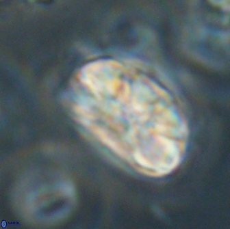 Heliolithus iptamenosdiskos 65813