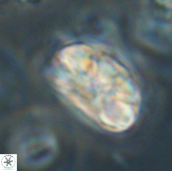 Heliolithus iptamenosdiskos 65813