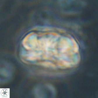 Heliolithus iptamenosdiskos 65815