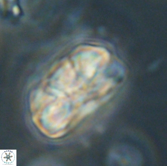 Heliolithus iptamenosdiskos 65816