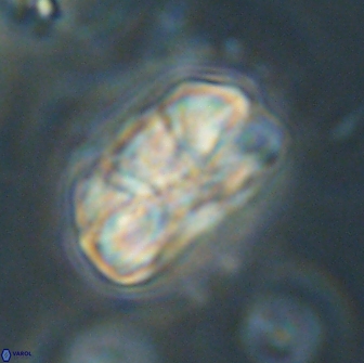 Heliolithus iptamenosdiskos 65817