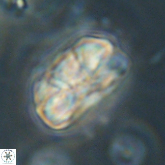 Heliolithus iptamenosdiskos 65817
