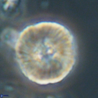 Heliolithus iptamenosdiskos 65818