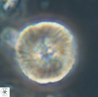 Heliolithus iptamenosdiskos 65818