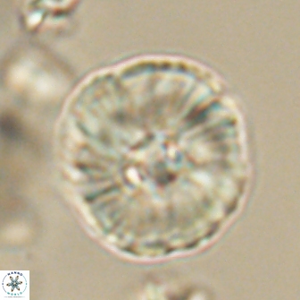 Heliolithus iptamenosdiskos 65819