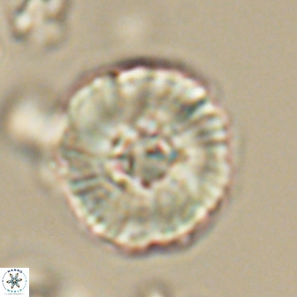 Heliolithus iptamenosdiskos 65820