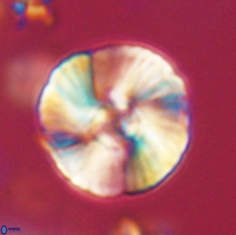 Heliolithus iptamenosdiskos 65821