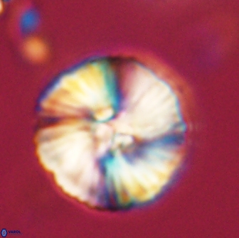 Heliolithus iptamenosdiskos 65825