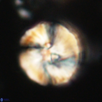 Heliolithus iptamenosdiskos 65826