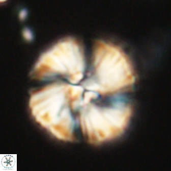 Heliolithus iptamenosdiskos 65827