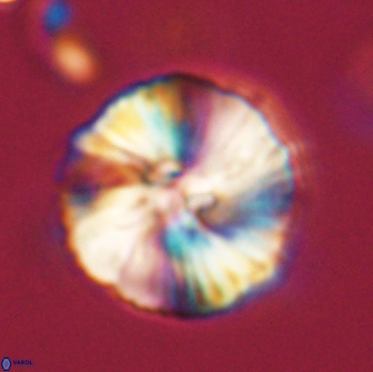 Heliolithus iptamenosdiskos 65829