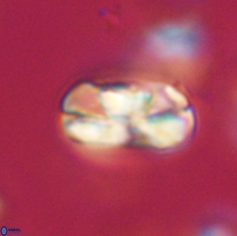 Heliolithus iptamenosdiskos 65847