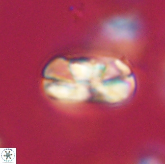 Heliolithus iptamenosdiskos 65847
