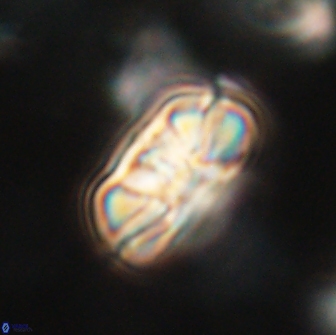 Heliolithus iptamenosdiskos 65850