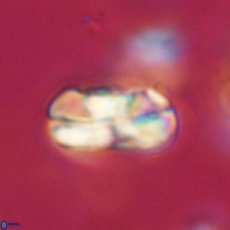 Heliolithus iptamenosdiskos 65852