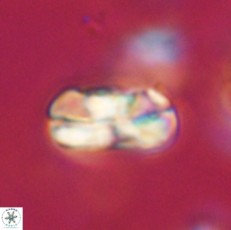 Heliolithus iptamenosdiskos 65852