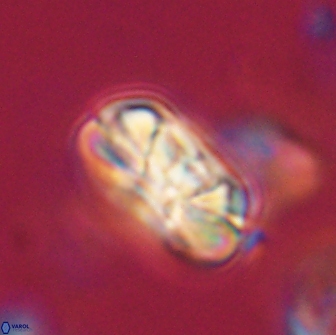 Heliolithus iptamenosdiskos 65853