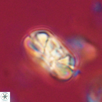 Heliolithus iptamenosdiskos 65853
