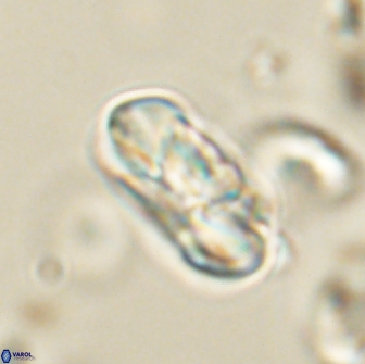 Heliolithus iptamenosdiskos 65855