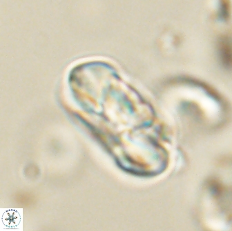 Heliolithus iptamenosdiskos 65855
