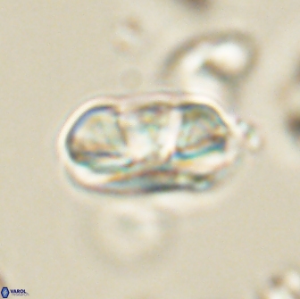 Heliolithus iptamenosdiskos 65856