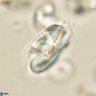 Heliolithus iptamenosdiskos 65857