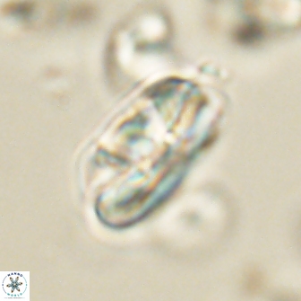 Heliolithus iptamenosdiskos 65857