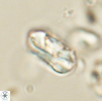 Heliolithus iptamenosdiskos 65858