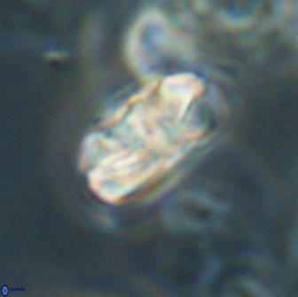 Heliolithus iptamenosdiskos 65859