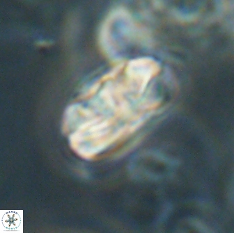 Heliolithus iptamenosdiskos 65859